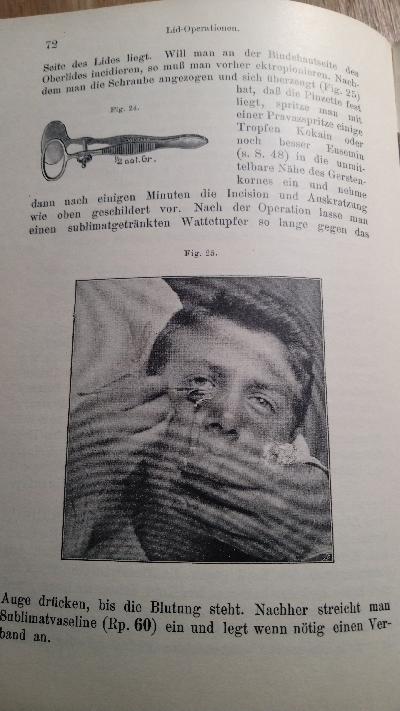 Therapeutisches Taschenbuch für die Augenpraxis - Front Cover